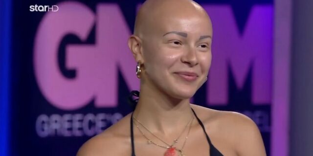 GNTM: Η Λυδία, η αλωπεκία και το μήνυμα κατά των προτύπων ομορφιάς