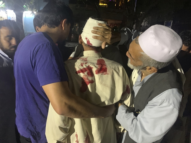 Καμπούλ: Ισχυρή έκρηξη από παγιδευμένο αυτοκίνητο