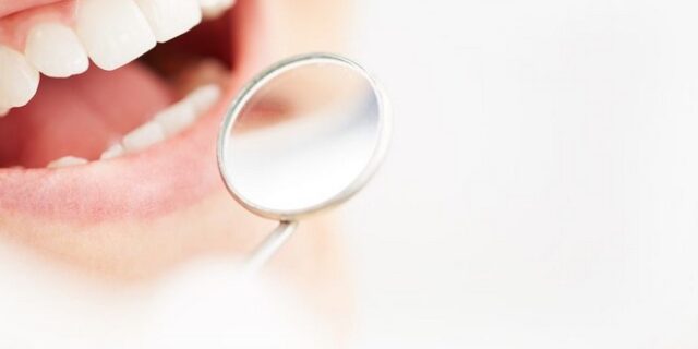 Λεύκανση δοντιών: Ποια είναι η καλύτερη μέθοδος – Πόσο συχνά πρέπει να γίνεται