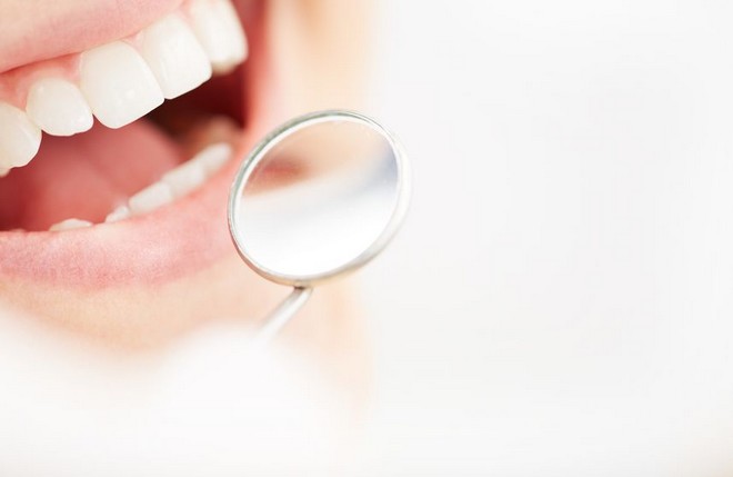 Λεύκανση δοντιών: Ποια είναι η καλύτερη μέθοδος – Πόσο συχνά πρέπει να γίνεται