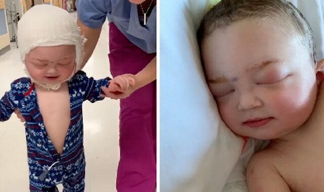 Μωράκι χαμογελάει και τραγουδάει 24 ώρες μετά από εγχείρηση στο κεφάλι