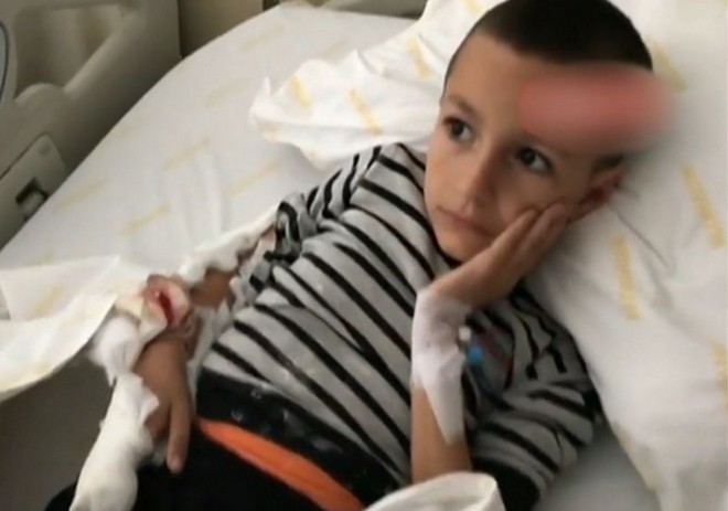 Τουρκία: 7χρονο παιδί δέχτηκε επίθεση από πίτμπουλ