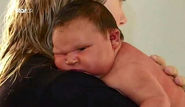 Αυστραλία: Μωρό γεννήθηκε σχεδόν 6 κιλά – “Μοιάζει με αθλήτρια σούμο!”