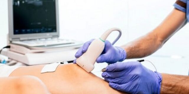 “Sonosurgery”:  Η θεραπεία για τις επίμονες τενοντίτιδες