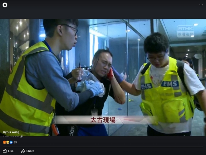 Χονγκ Κονγκ: Επίθεση με μαχαίρι σε εμπορικό κέντρο – Ο δράστης έκοψε αυτί περαστικού