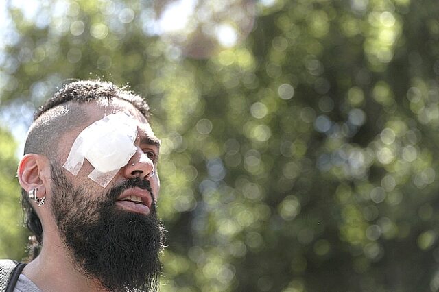 Χιλή: Διαδήλωση για τα “χαμένα μάτια” στο Σαντιάγο