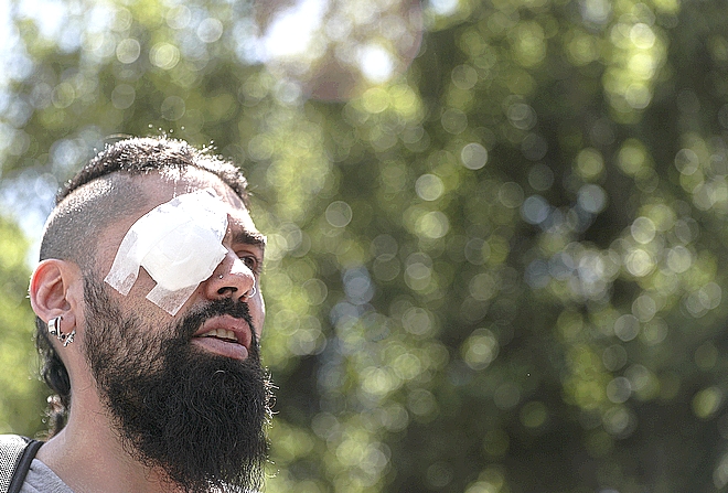 Χιλή: Διαδήλωση για τα “χαμένα μάτια” στο Σαντιάγο