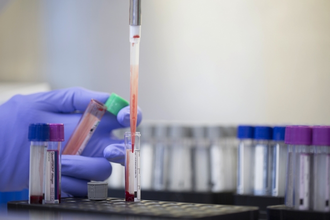 Νέο τεστ αίματος: Θα δείχνει εάν μία γυναίκα θα έχει εμμηνόπαυση στα επόμενα 2 χρόνια