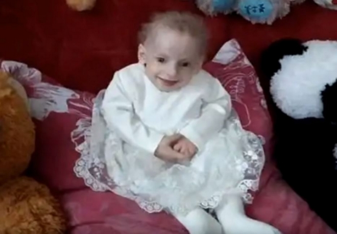 Ουκρανία: Κοριτσάκι 8 ετών πέθανε από γηρατειά