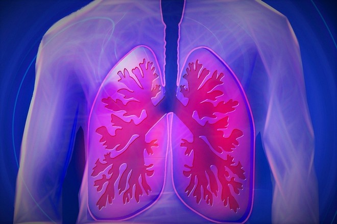 Καρκίνος του Πνεύμονα: Πρόληψη, συμπτώματα και αντιμετώπιση