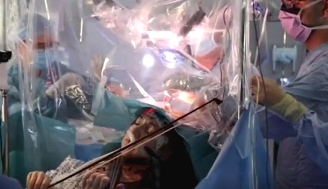 Συγκλονιστικό: Γυναίκα παίζει βιολί την ώρα που χειρουργείται στον εγκέφαλο