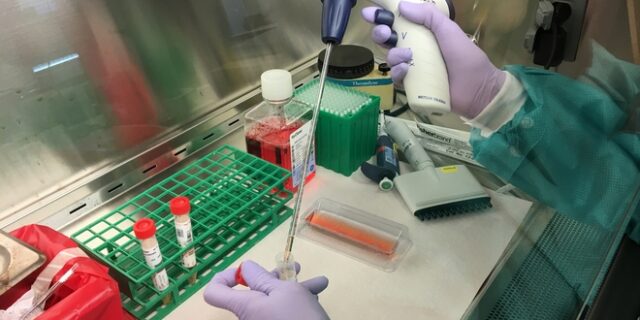Κορονοϊός: Τρία τα κρούσματα στη Βόρεια Μακεδονία