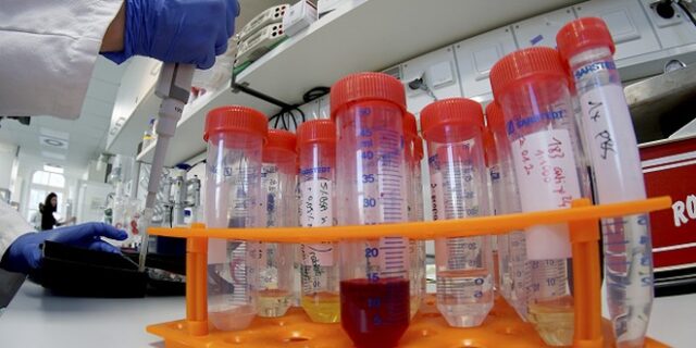 Ο περιορισμός των αναγκαίων τεστ εξελίσσεται σε μείζον πρόβλημα και εμποδίζει την ανίχνευση κρουσμάτων