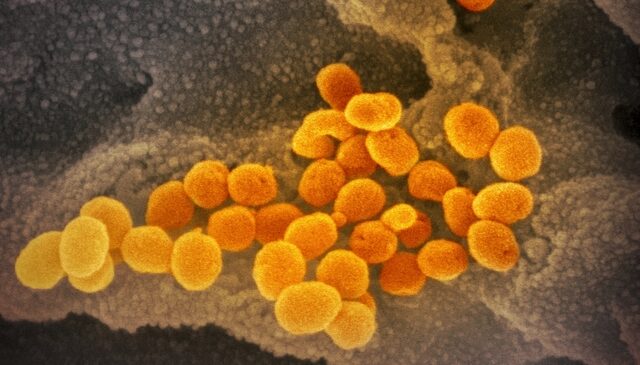 Κορονοϊός: Σπουδαία ανακάλυψη – Ερευνητές απομόνωσαν ένζυμο πολλαπλασιασμού
