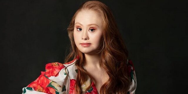 Μάντλιν Στούαρτ στο NEWS 24/7: Το μοντέλο με Σύνδρομο Down