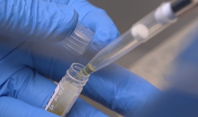 Κορονοϊός – ΗΠΑ: Δοκιμές πειραματικού φαρμάκου κατά του ιού