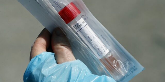 Στην πρώτη γραμμή κατά του κορονοϊού και το Εθνικό Κέντρο Αιμοδοσίας