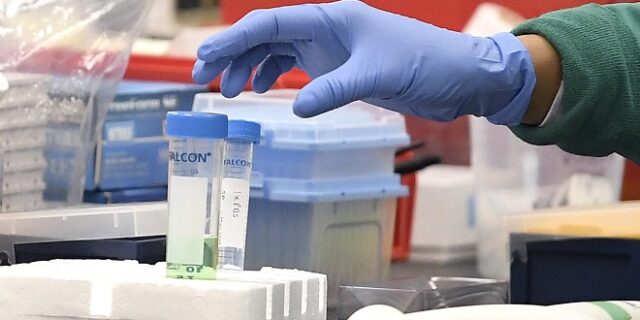 Κορονοϊός-Ρωσία: Η παρασκευή του εμβολίου ολοκλήρωσε την πρώτη φάση