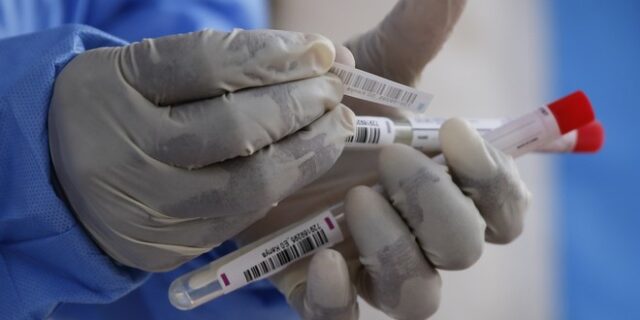 Δ. Παρασκευής για κορονοϊό: Πότε ξεκίνησε η επιδημία στην Ελλάδα