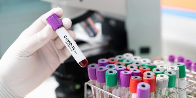 Η Ελβετία ξεκινά έρευνα για την ανοσία στον κορονοϊό