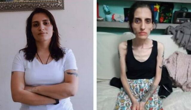 Τουρκία: Πέθανε η τραγουδίστρια Helin Bolek μετά από 288 ημέρες απεργίας πείνας