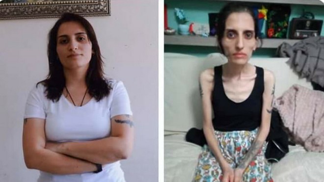Τουρκία: Πέθανε η τραγουδίστρια Helin Bolek μετά από 288 ημέρες απεργίας πείνας
