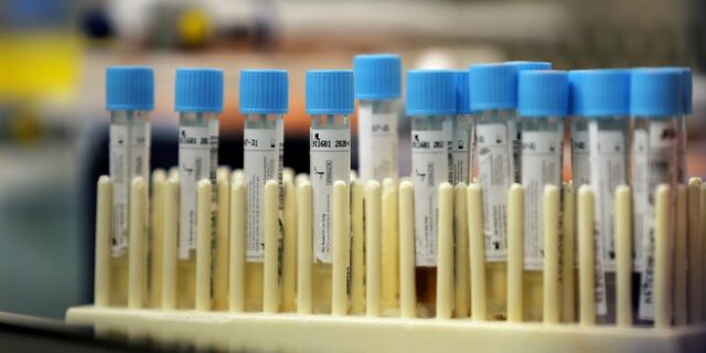 Το φάρμακο Anakinra δίνει ελπίδα στην μάχη κατά του κορονοϊού