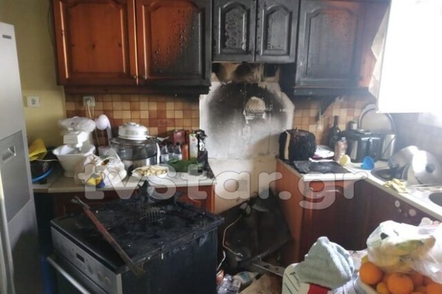Αμάρυνθος: 47χρονη με σοβαρά εγκαύματα από φωτιά στο σπίτι της