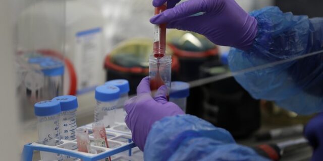 ΗΠΑ: Αβέβαια τα πρώτα αποτελέσματα από τη θεραπεία με χορήγηση πλάσματος