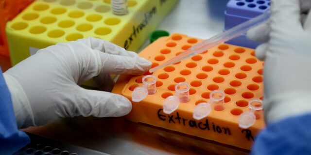 Ορολογικά τεστ για τον κορονοϊό: Οι δυνατότητες και οι περιορισμοί