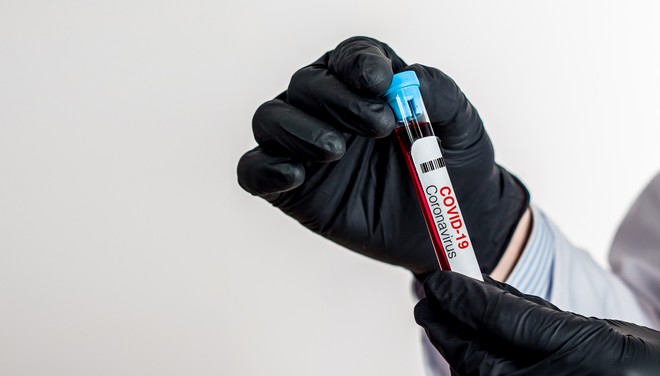 Εμβόλιο κορονοϊού: Θετικά τα νέα από τις πρώτες δοκιμές της Moderna