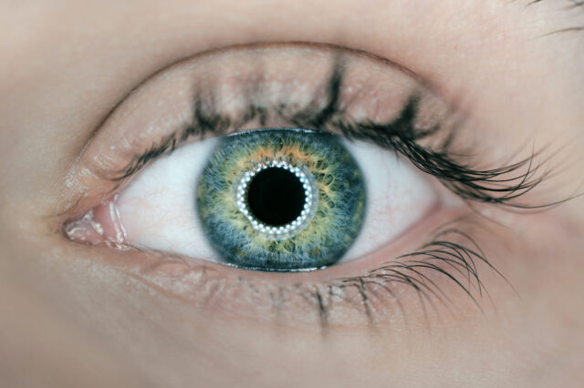 Καταρράκτης ματιών: Τα συμπτώματα και η σύγχρονη θεραπεία