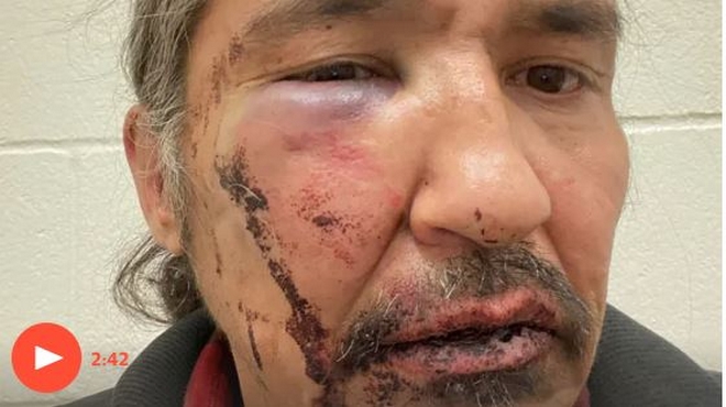 Καναδάς: Ινδιάνος χτυπήθηκε από αστυνομικούς επειδή είχε “ληγμένες” πινακίδες