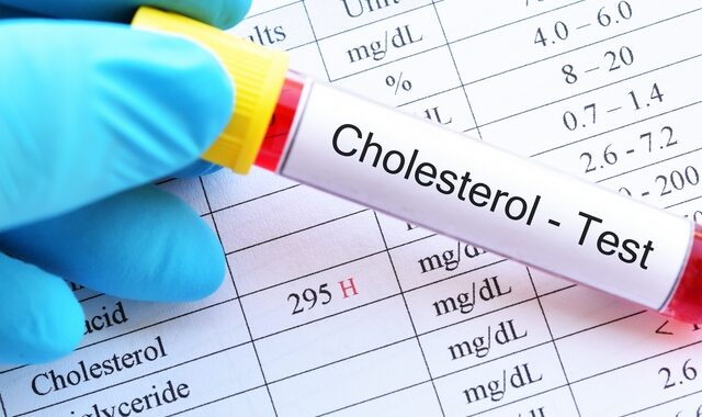 Σε καλό δρόμο οι έρευνες για τη μείωση της “κακής” χοληστερίνης
