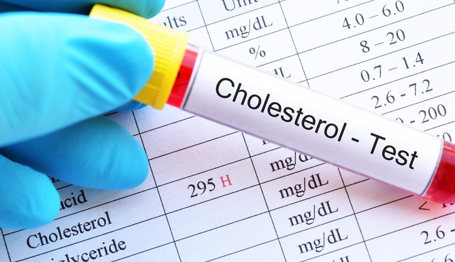 Σε καλό δρόμο οι έρευνες για τη μείωση της “κακής” χοληστερίνης