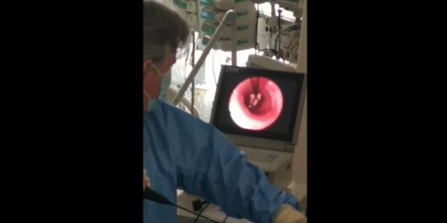 Πάτρα: Συγκλονιστικό βίντεο – Πώς έσωσαν βρέφος 10 μηνών που κατάπιε καρύδι