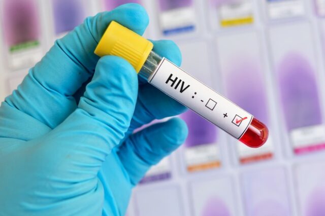 HIV: Μάλλον έχουμε τον πρώτο ασθενή στον κόσμο που θεραπεύθηκε μόνο με φάρμακα