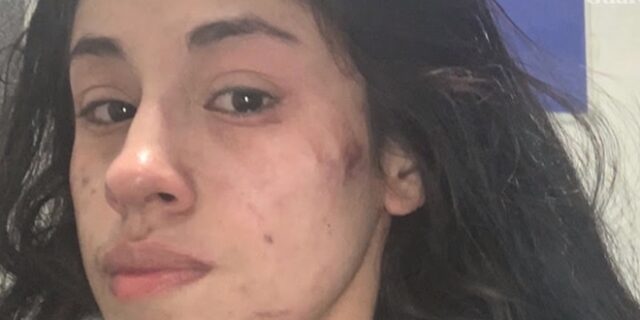 ΗΠΑ: Σάλος για τον αναίτιο ξυλοδαρμό 23χρονης από αστυνομικό