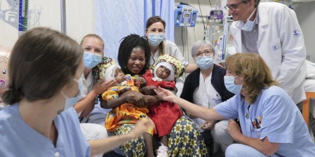 Ιατρικό θαύμα: Διαχώρισαν σιαμαία δίδυμα με τεχνολογία 3D