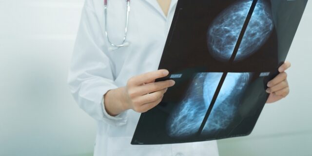 Δωρεάν μαστογραφικοί έλεγχοι από το δήμο Αθηναίων