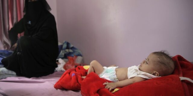 ΟΗΕ: Τα παιδιά της Υεμένης λιμοκτονούν