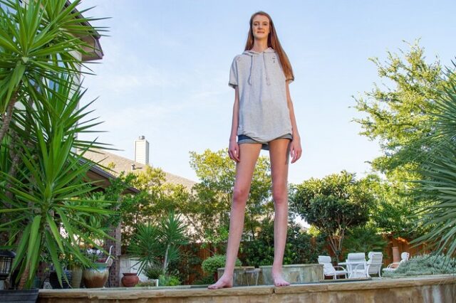 Maci Currin: Η 17χρονη που έσπασε 2 ρεκόρ Γκίνες λόγω των μακριών της ποδιών
