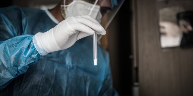 Κορονοϊός: 303 νέα κρούσματα στην Ελλάδα – Οκτώ νέοι θάνατοι