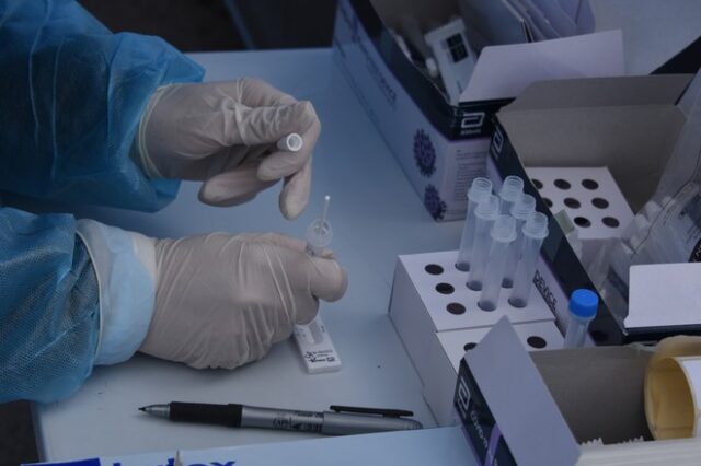 Κορονοϊός: Ισχυρό εργαλείο πλέον τα rapid test