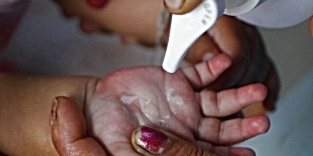 Μια ωδή στον άνθρωπο που έδωσε στον πλανήτη τα αντισηπτικά