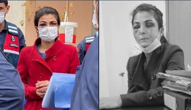 “Ελευθερώστε τη Μελέκ Ιπέκ” – Η γυναίκα που σκότωσε τον άντρα-βασανιστή της και κρατείται στη φυλακή