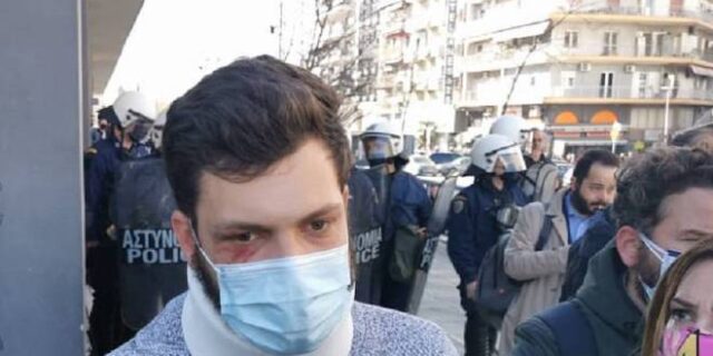 ΑΠΘ : Μήνυση κατά αστυνομικών καταθέτει τραυματισμένος φοιτητής