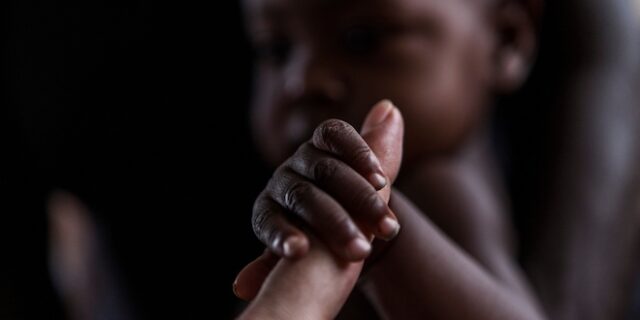 Νότιο Σουδάν: Ένας ύμνος για τη ζωή στη Μονάδα Εντατικής Θεραπείας των Γιατρών Χωρίς Σύνορα