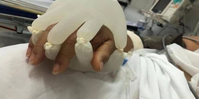 “Το χέρι του Θεού”: Νοσοκόμες στη Βραζιλία παρηγορούν τους ασθενείς με Covid-19 με συγκινητικό τρόπο