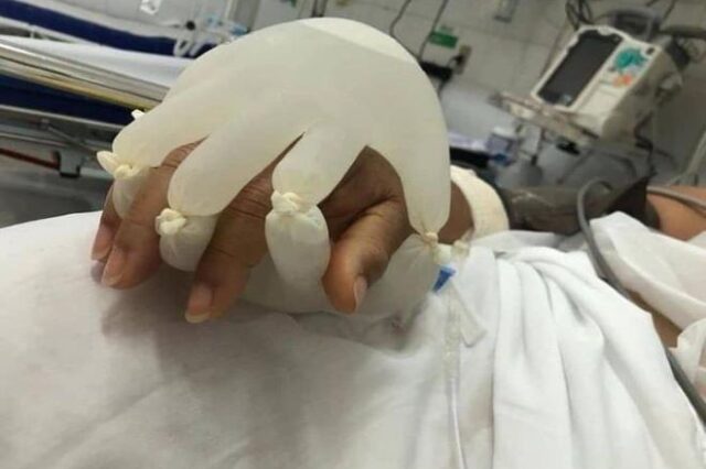 “Το χέρι του Θεού”: Νοσοκόμες στη Βραζιλία παρηγορούν τους ασθενείς με Covid-19 με συγκινητικό τρόπο
